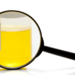 Presença de raras bactérias no resultado de exame de urina