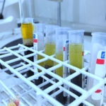 vitamina b exame-sangue