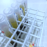 Exame colinesterase em intoxicação por inseticidas organofosforados