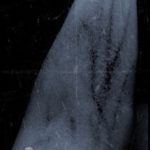 imagem do app veinSeek busca veias