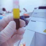 exame de sangue coleta de material