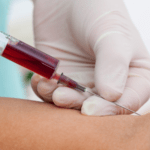 Exame de sangue coleta e resultado