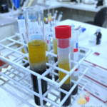 exame de sangue tubo de ensaio coleta