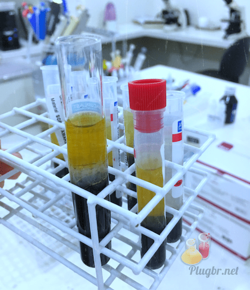 exame de sangue tubo de ensaio coleta