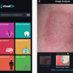 aplicativo dermatologia ajuda profissionais