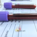 Exame de sangue hemograma bastonetes