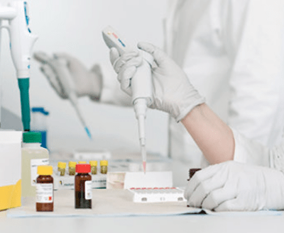 Análise exame macroprolactina sangue