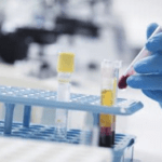 exame de sangue hemograma