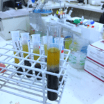 exame candida anticorpos IgG IgM IgA