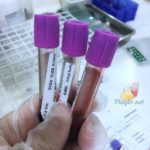 exame imunoglobulina fator Rh