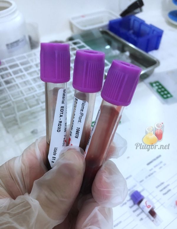 exame imunoglobulina fator Rh