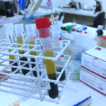 teste sangue haptoglobina exame plugbr.net