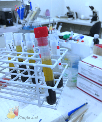 teste sangue haptoglobina exame plugbr.net