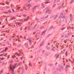 pigmentos por hemossiderina exame