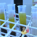 teste exame transferrina