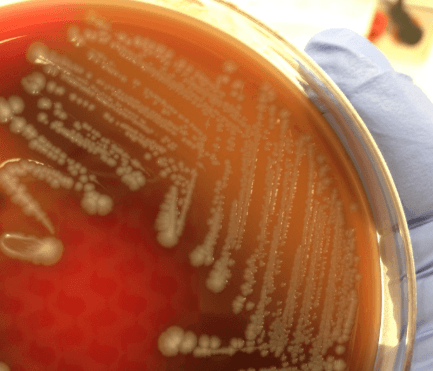 E Coli No Resultado Do Exame De Cultura De Urina E Outras Bacterias Em Uroculturas Plugbr Net