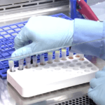 Exame de sangue carboxihemoglobina