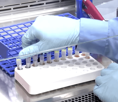 Exame de sangue carboxihemoglobina