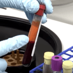 Melhorar resultado de exame de sangue