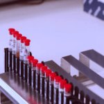 Exame de sangue coleta de fosfolipídios