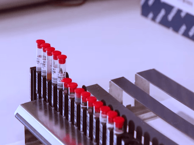 Exame de sangue coleta de fosfolipídios