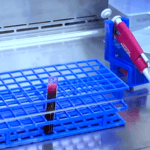 Exame de sangue laboratorial