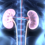 medicamentos cólica rins