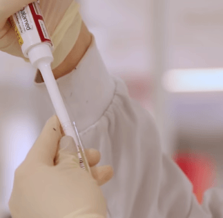 exames pré-diabetes e diagnóstico