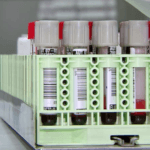 Exame de sangue brucelose