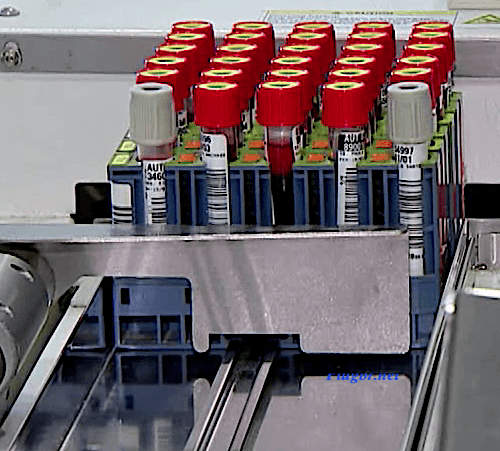 exame sorologia filariose