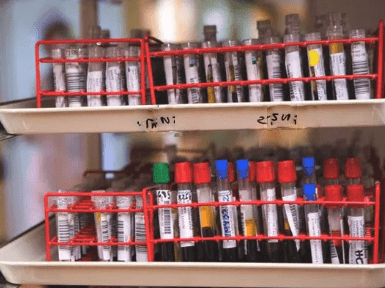 exame anti mitocondria